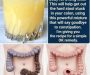 Healthy 3-Ingredient Ginger Lemon Water